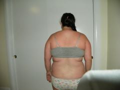 Back