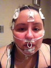 Sleep Study