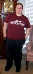 Before Surgery picture