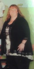Me Jan.27,2012 (Before surgery)