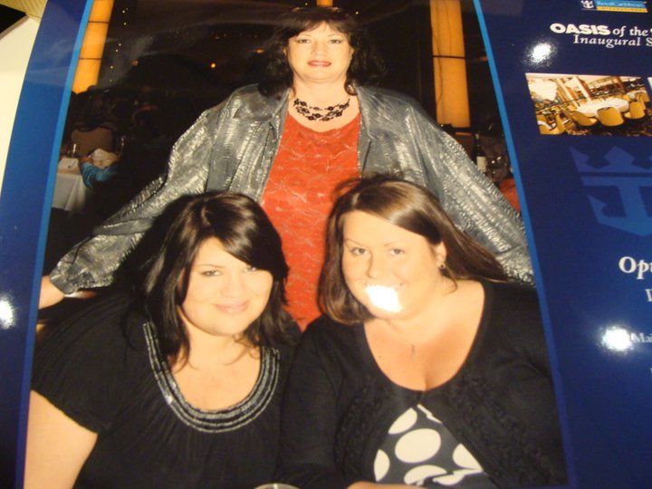 253 pounds! before surgery