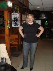 Pic taken maybe 6 months after surgery??