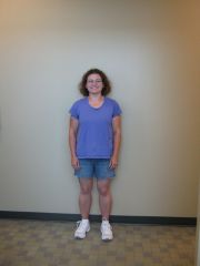 One year Post-op 8/2011