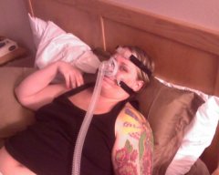 Before surgery at my sleep study.