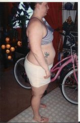 6/10/08 day before surgery 260