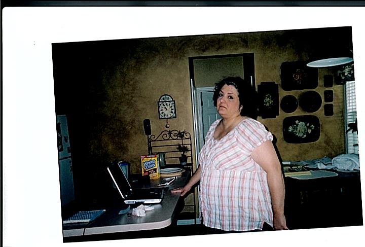 Before Lap Band Surgery June 2008