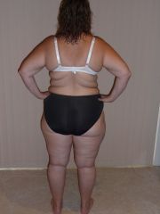 Post LapBand Op   1 Year   07052011 (5)