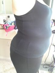 Post Op 5 days Band Removal   19062012 103.6kg Side