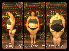 before surgery 362