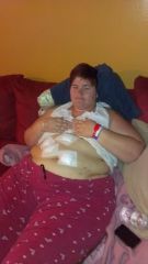 after surgery..swollen and hurting