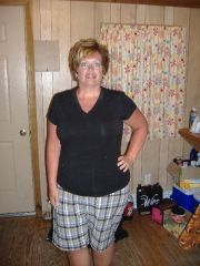 The beach summer of my surgery