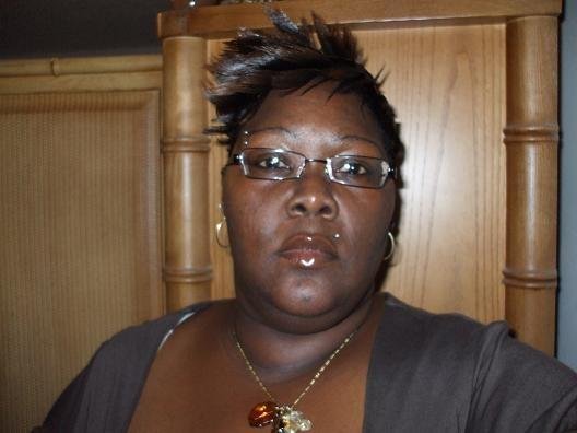 Before Surgery Pictures