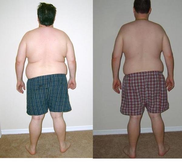Before and Afters