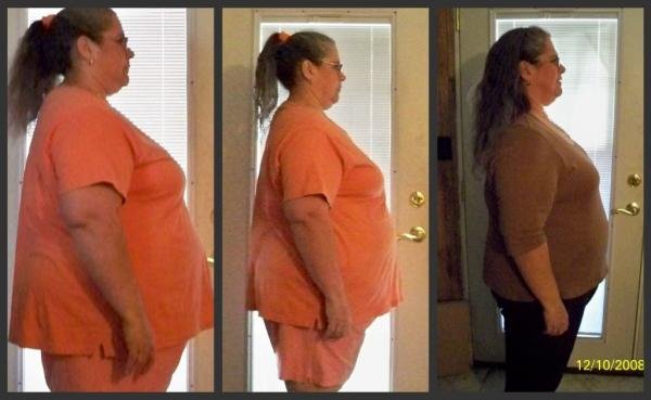Before & After Pics