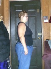 day before my lapband surgery side view