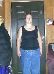 day before my lapband surgery front