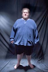 Ken - Pre-Op - 05022010.jpg