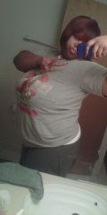 b4 surgery