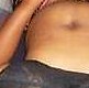 b4 surgery