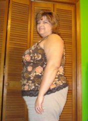 My "Before" photo -- 4 weeks before surgery.