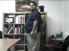 1 Week after Surgery 8/24/2012