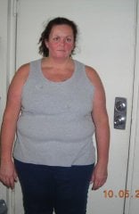Night before LapBand Surgery 10 05 08 6.30pm 005