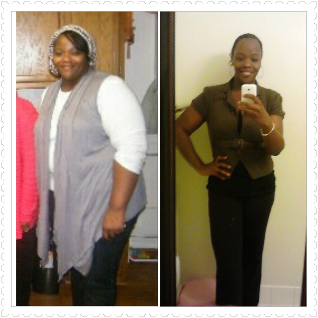 Before/After Comparison Photos 