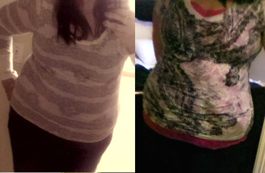 Pre-Op weight loss