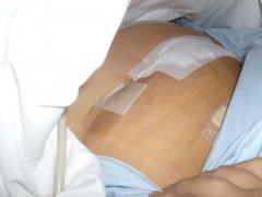 My scars

S6302258