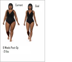 Weight loss Simulator 
6 weeks Post-OP