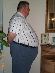Day before surgery @ 494#
