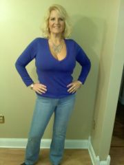 12/03/09 2 weeks post op from plastic surgery.