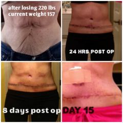 collage tummy 4 pics