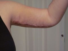 IMG 0660