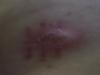 post-204171-13813131563423_thumb.jpg