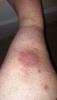 post-238057-14210171448453_thumb.jpg