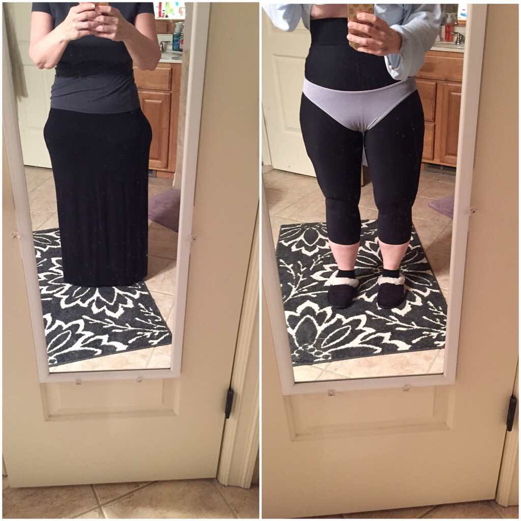 What was your experience with Liposuction?