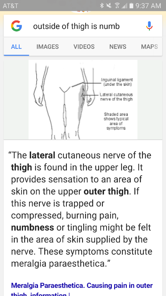 Numbness in legs and stomach, tingling in feet