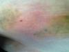 post-22442-13813811348925_thumb.jpg