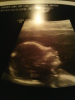 post-22621-13813663104768_thumb.png