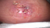 post-44088-13813662763173_thumb.png
