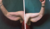 post-116515-0-10438400-1393545769_thumb.png