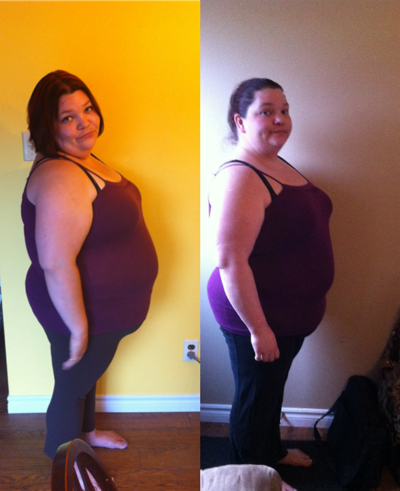 New Lapband Member with PCOS