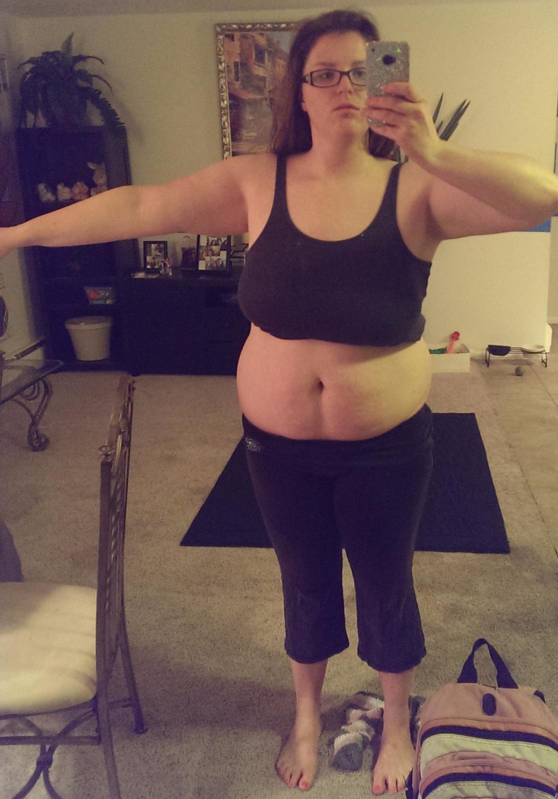 Before And After One Year Post Op (PICS)