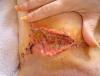 post-288511-13813139239427_thumb.jpg