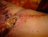 post-288511-13813139239819_thumb.jpg