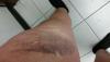 post-250028-0-87143300-1460046421_thumb.jpg