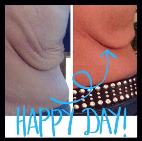 Firming lotions for the loose skin?