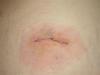 post-220731-13813135103423_thumb.jpg