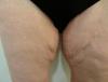 post-290983-13813140136405_thumb.jpg